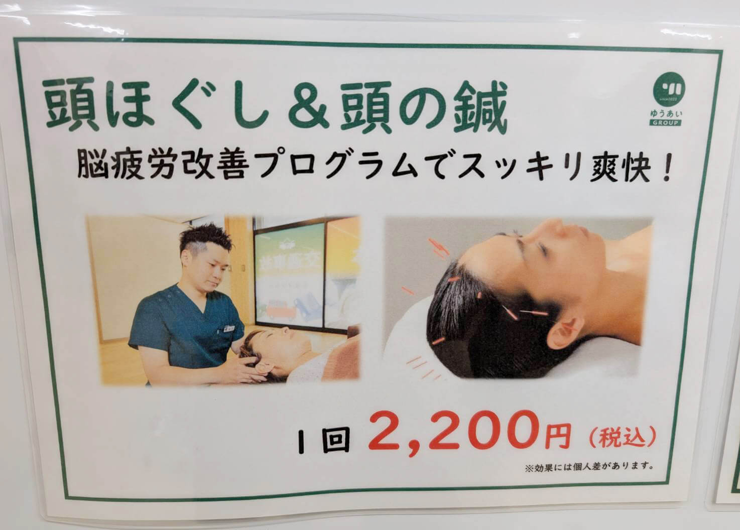 頭ほぐし&頭の鍼の説明画像