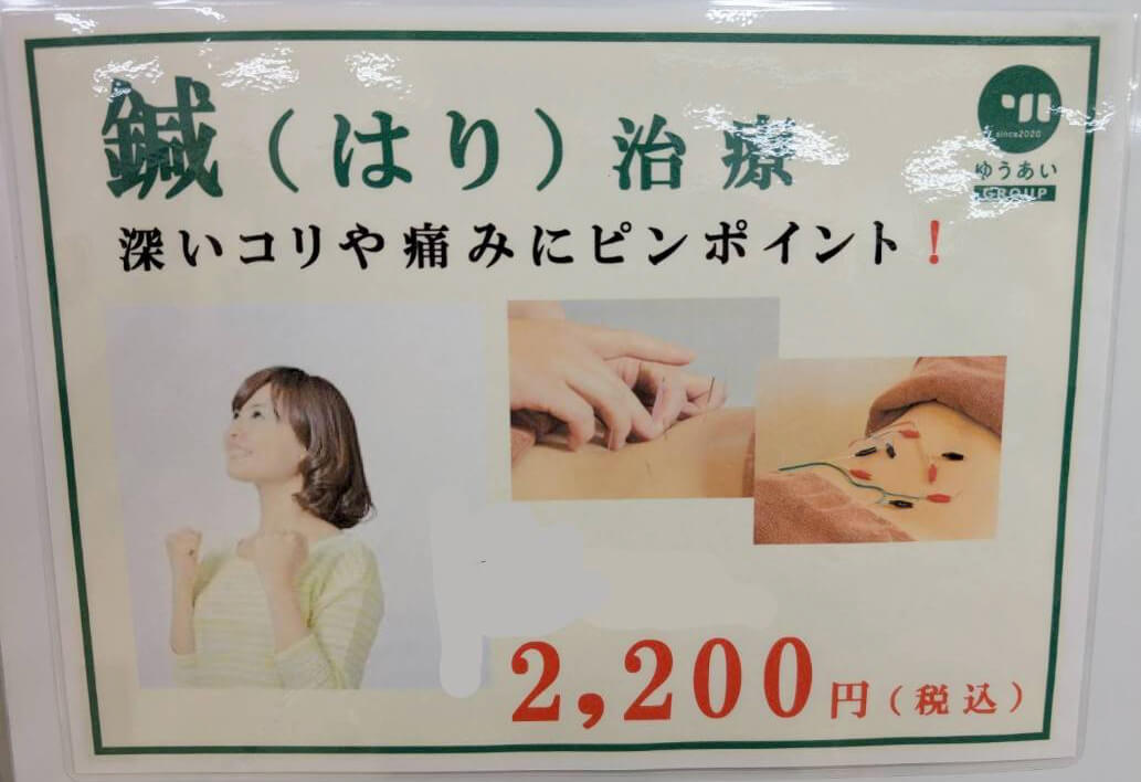 鍼(はり)治療の説明画像